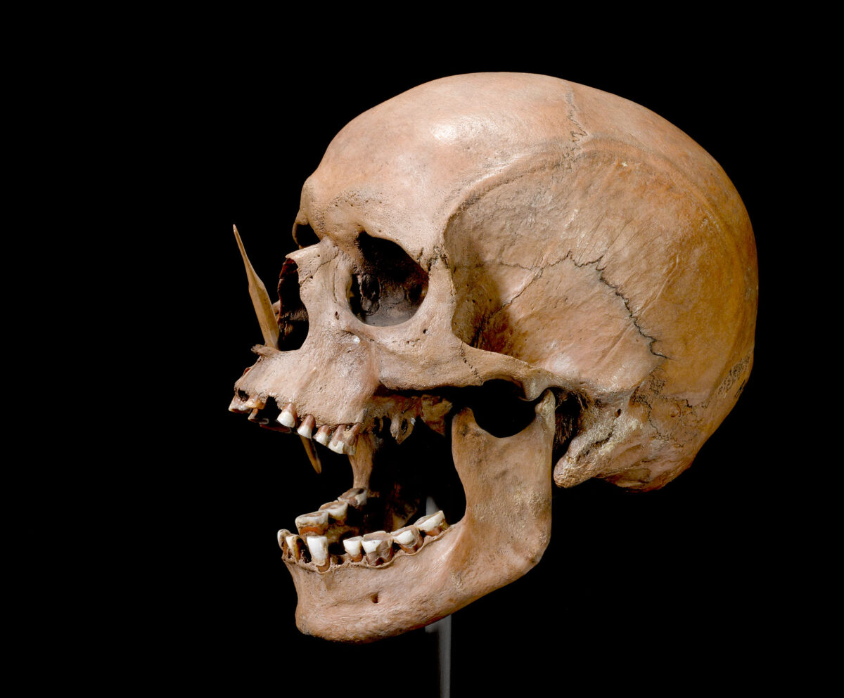 Ο άνθρωπος Porsmose. Xρονολογείται τη Νεολιθική περίοδο και βρέθηκε με ένα κεφάλι βέλους στη μύτη το 1947 στην περιοχή Porsmose της Δανίας. Φωτ.: The Danish National Museum.